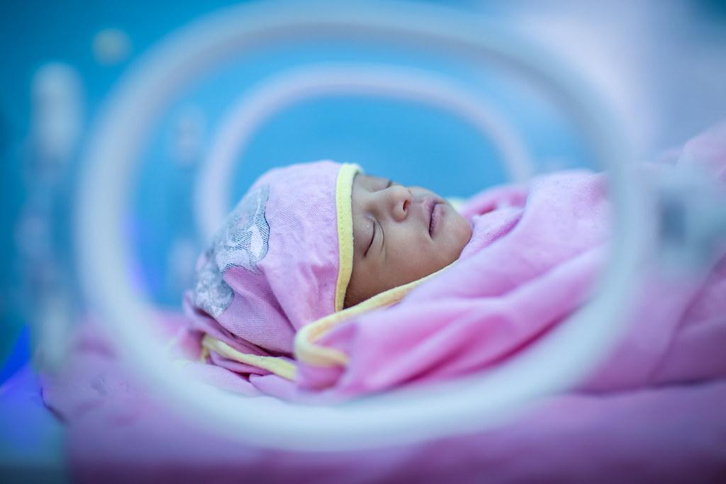 A Term Baby Was Vigorous At Birth